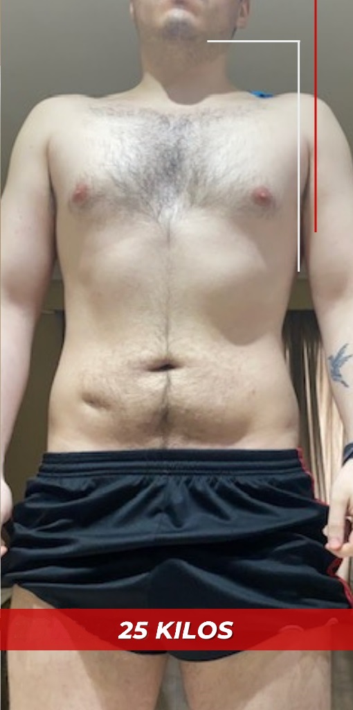 Antes y después